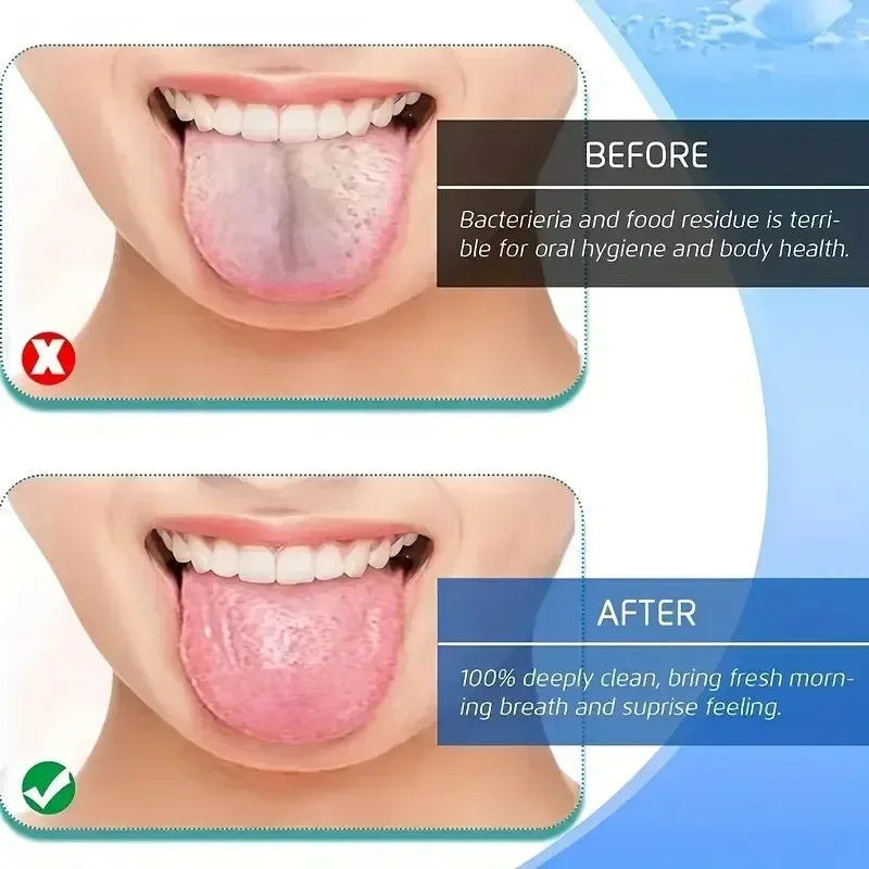 👅 Stainless Steel Tongue Scraper (4 Colors) – Fresh Breath & Oral Hygiene Made Simple
